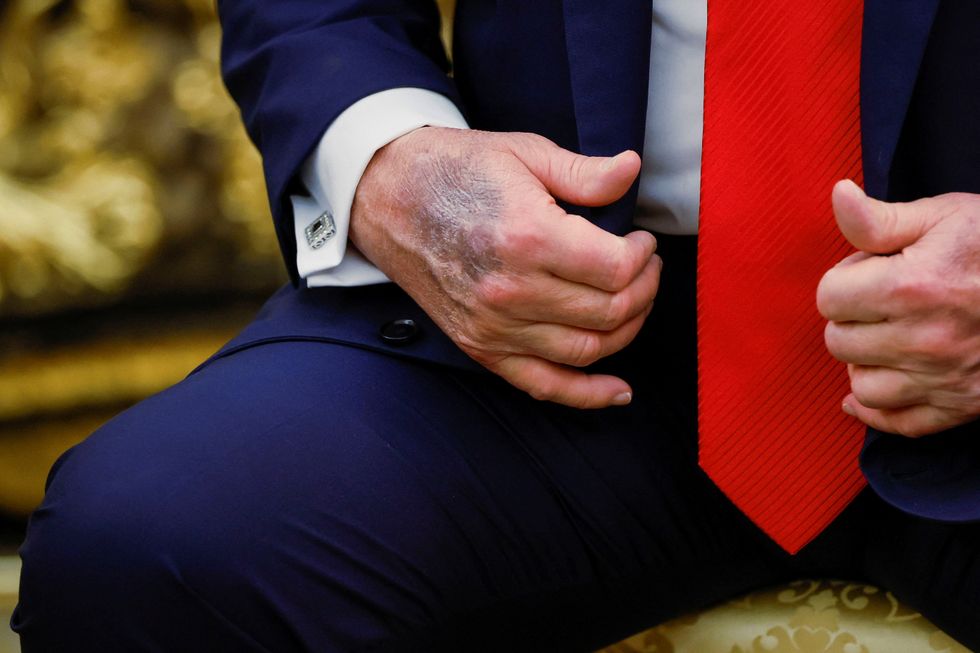Social media unloads on ailing Trump's 'excellent health' claim