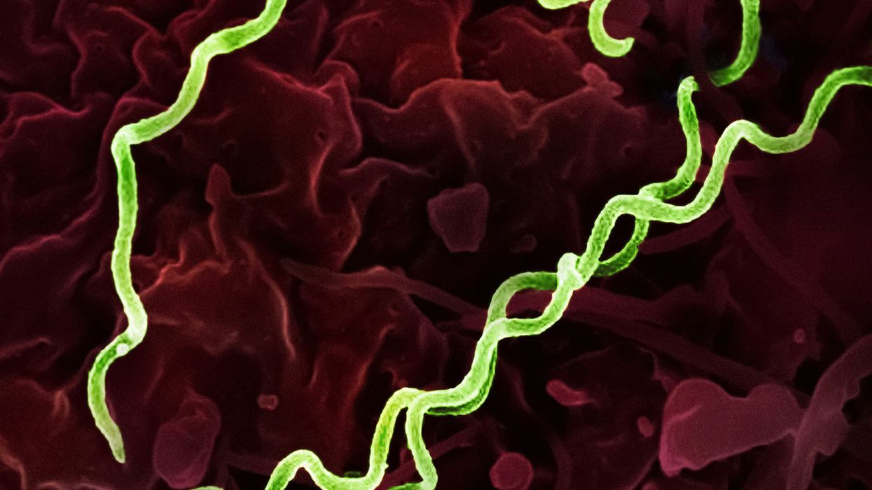 Surge in syphilis cases leads some providers to ration penicillin