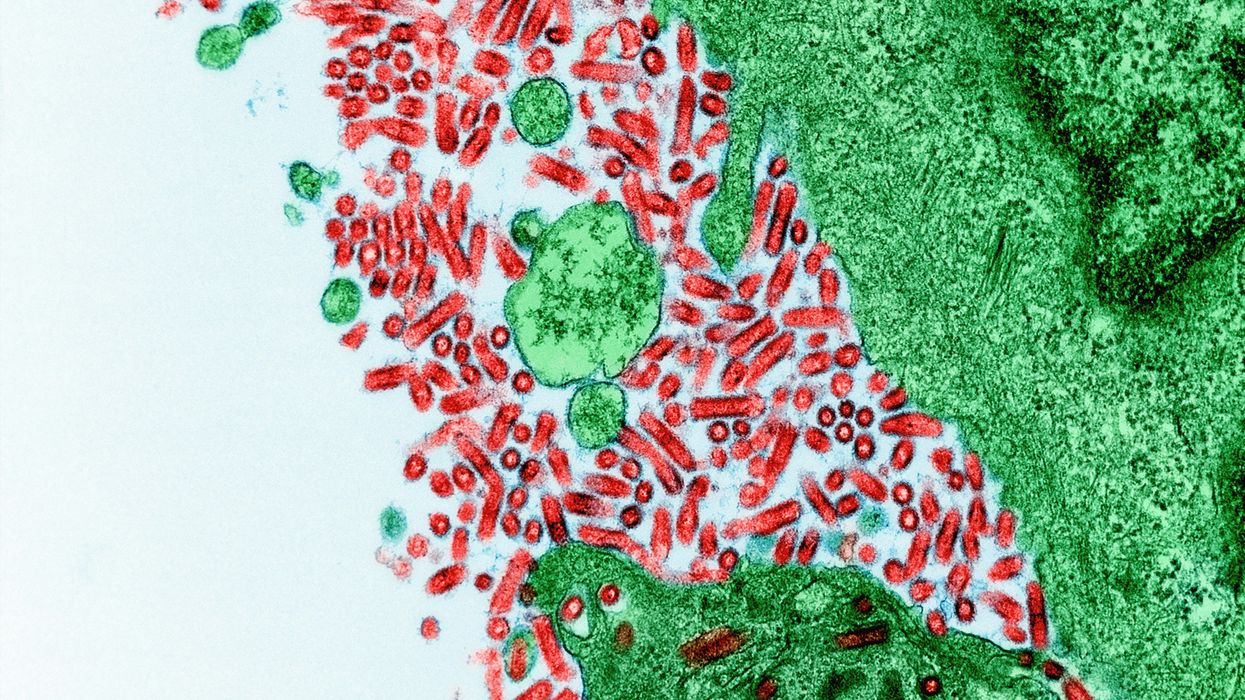 A Kentuckian with rabies has died