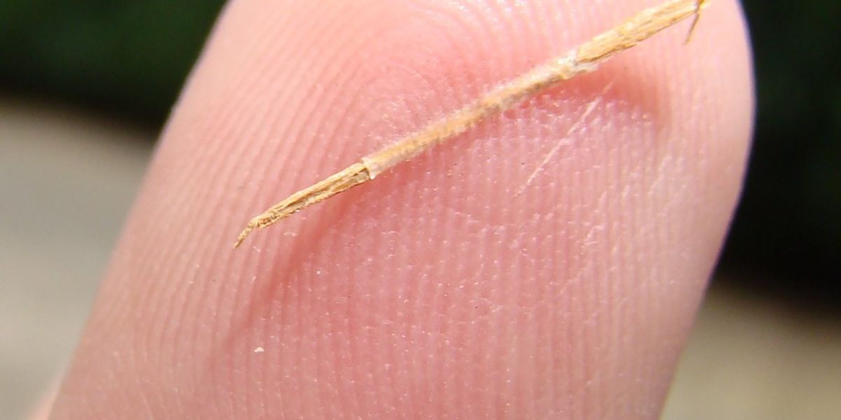 Removing a splinter? Treating a wart? If a doctor does it, it can be ...