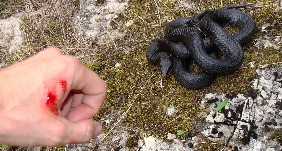 A 10-year-old girl's $67,957 snake bite is the exact reason we need Medicare for All