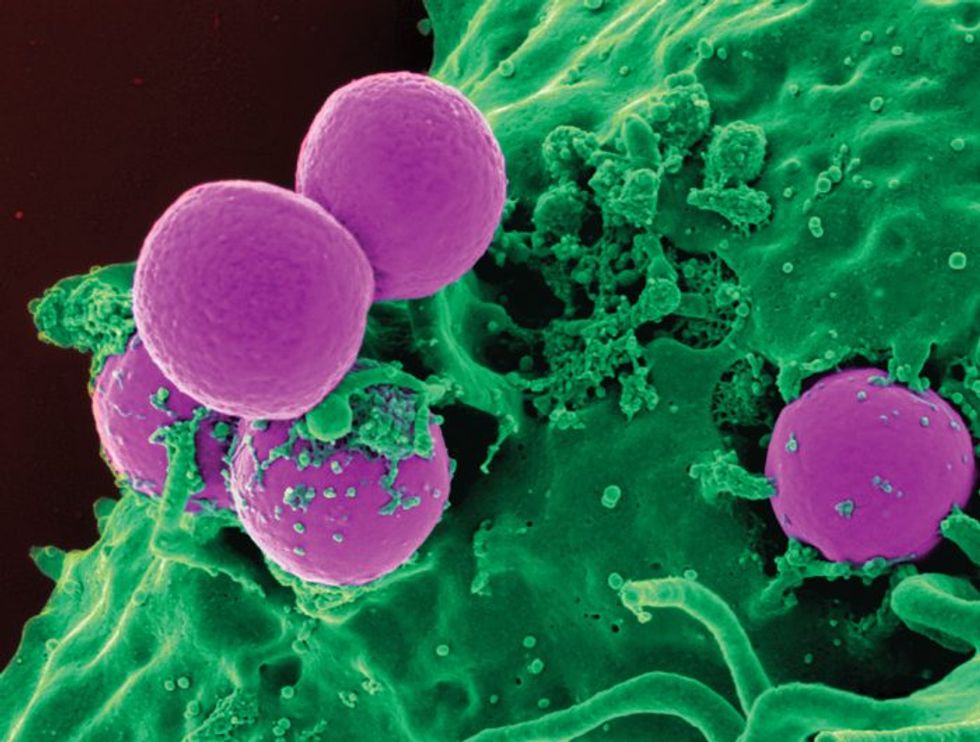 Antibiotic-Resistant Superbugs Are Getting Deadlier