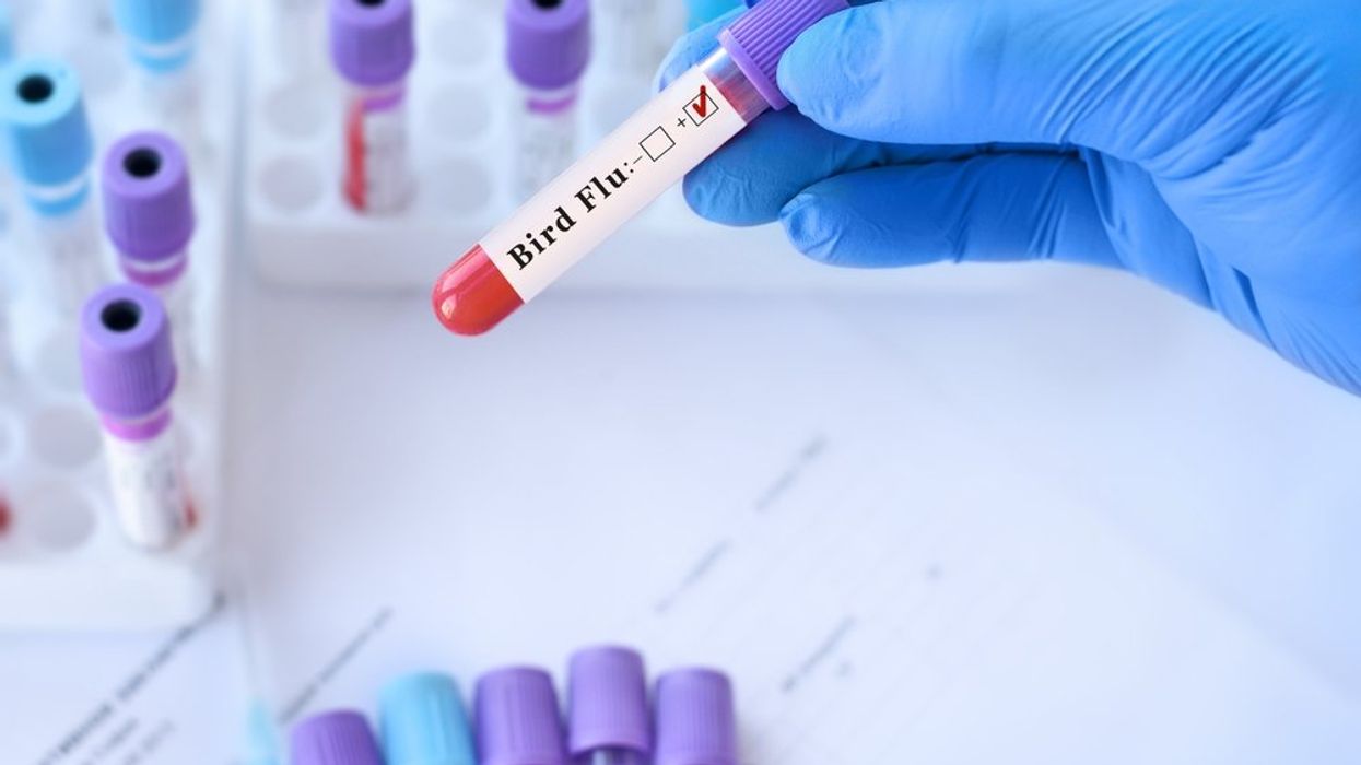 WHO announces first H3N8 bird flu death: report