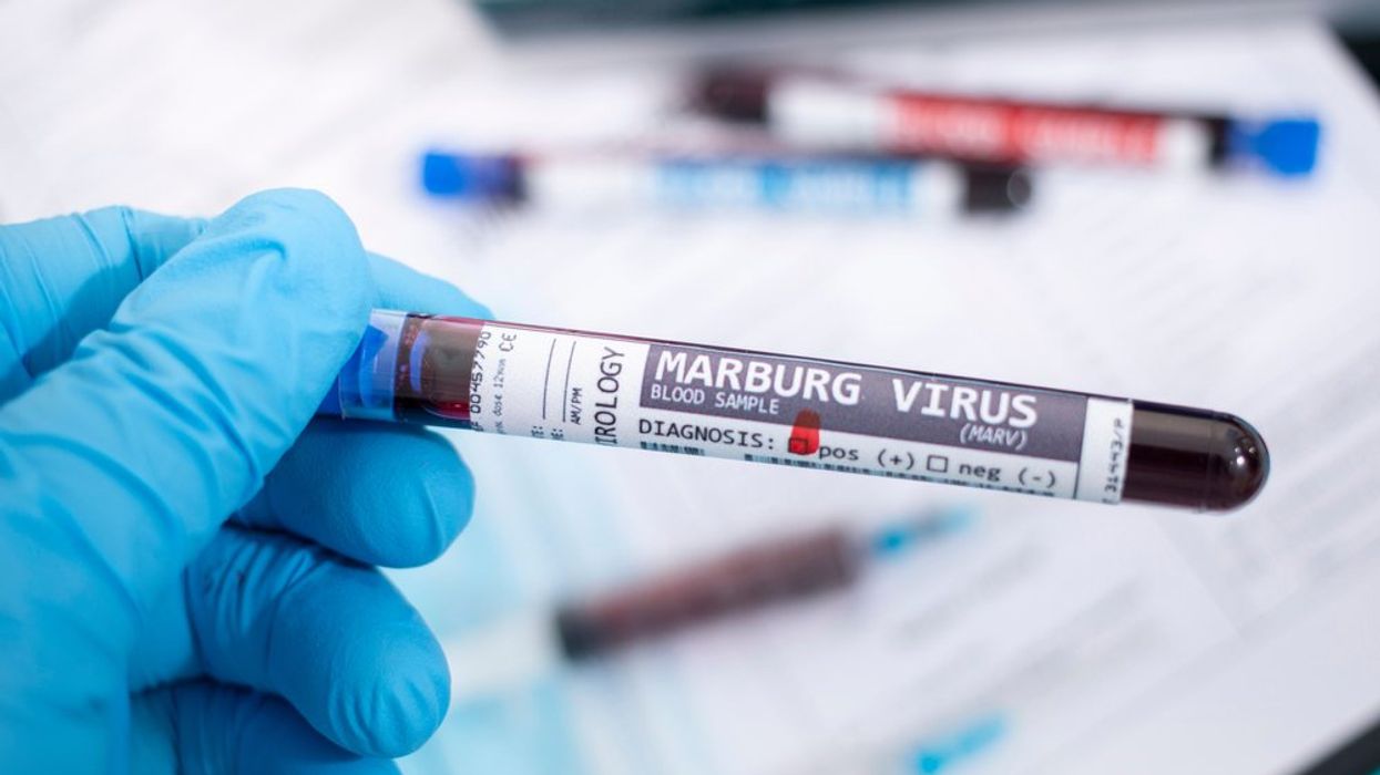 Why a 'viral hemorrhagic pandemic' could be on the way: report