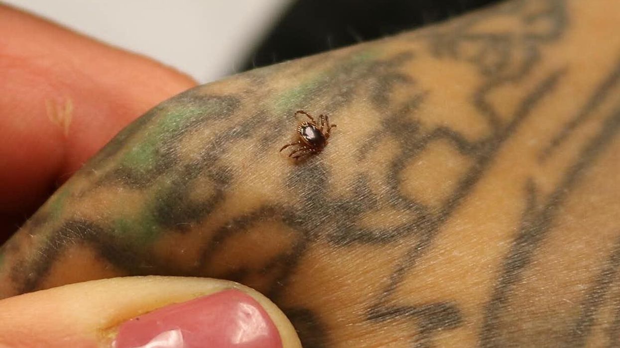A red meat allergy from tick bites is spreading