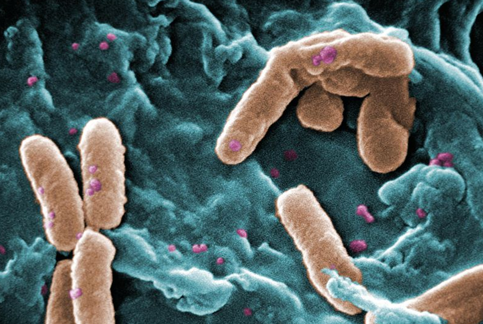 Why a new report finds that 'superbugs' could kill 10 million people a year by 2050