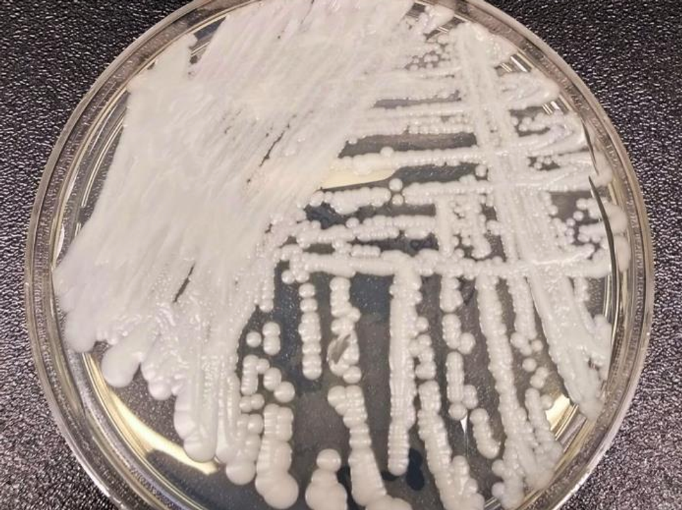 This frightening superbug is now deemed an 'urgent threat' — but hospitals have kept it quiet