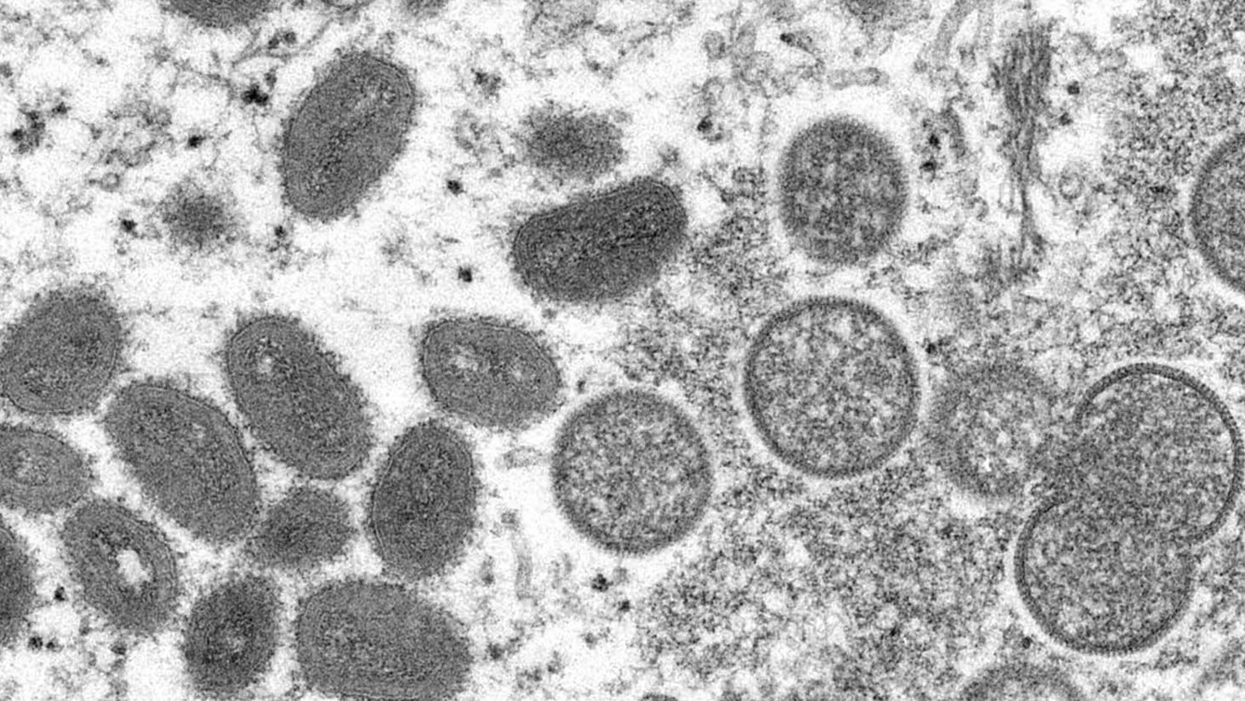 What is monkeypox? A microbiologist explains