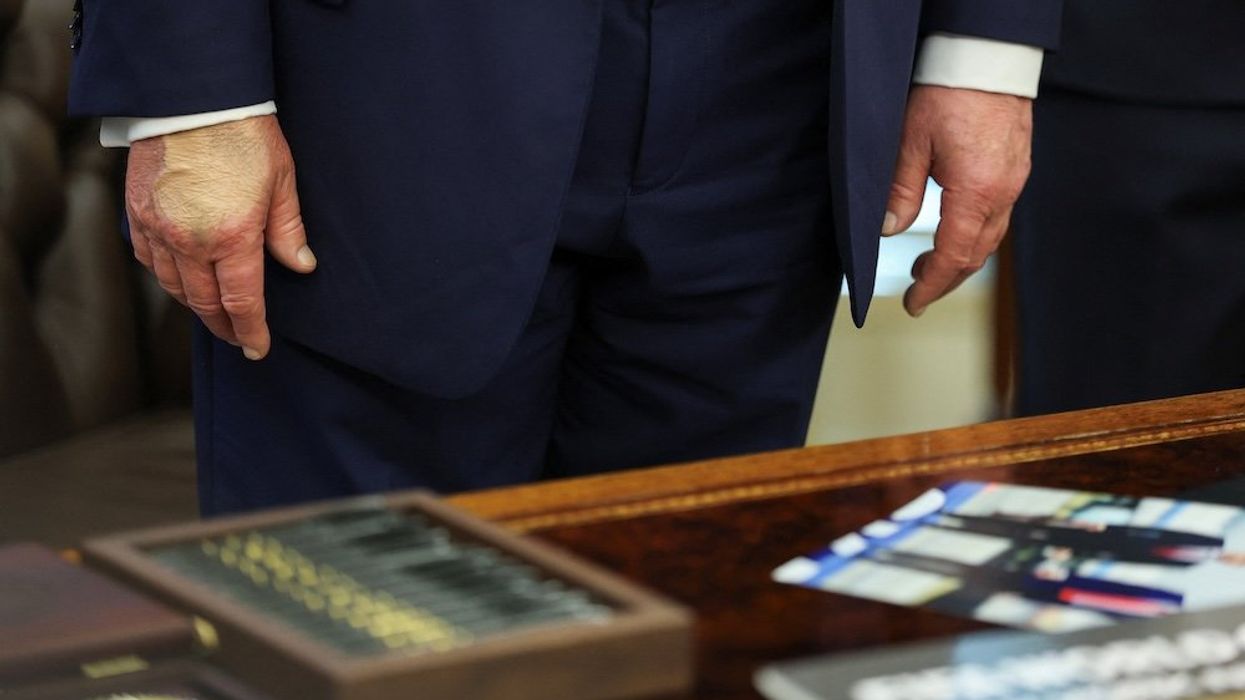 'He's not doing well': Psychologists say Trump showing telltale signs of 'early dementia'