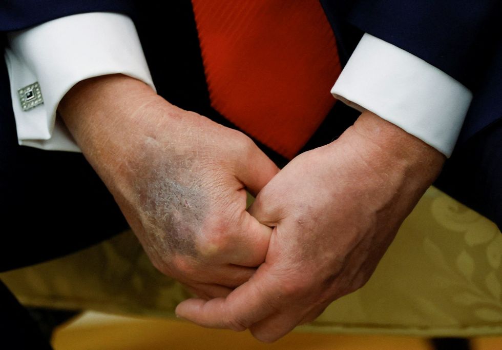Analysis reveals why MAGA chooses to buy Trump’s 'perfect' health lie